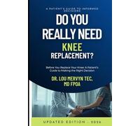 Do You Really Need Knee Replacement?: Before You Replace Your Knee: A Patient’s Guide to Making the Right Decision