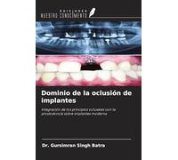 Dominio de la oclusión de implantes: Integración de los principios oclusales con la prostodoncia sobre implantes moderna