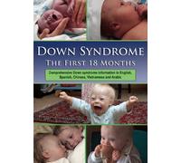 Down Syndrome: The First 18 Months [Reino Unido] [DVD]