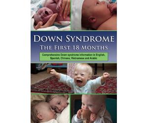Down Syndrome: The First 18 Months [Reino Unido] [DVD]