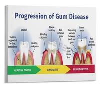 DPURPIWADY Gum Disease Stages Poster Periodontitis Guide Patient Education Clinic Wall-Art(Framed,08x12inch(20x30cm))