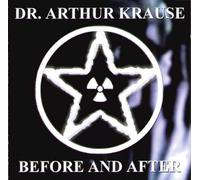 Dr. Arthur Krause - Before And After
