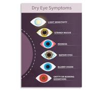 Dry Eye Symptoms Poster for Ophthalmology Clinic Office Decor