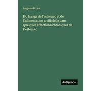 Du lavage de l'estomac et de l'alimentation artificielle dans quelques affections chroniques de l'estomac