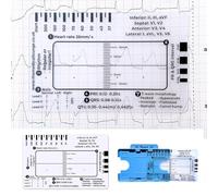 ECG - Regla de 7 pasos, regla de plástico ECG, herramienta de medición de tarjeta de bolsillo transparente ECG, tamaño de bolsillo 8,6 cm x 5,4 cm, para estudiantes, paramédicos, EMT, enfermeras y