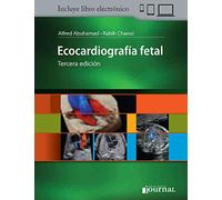 ECOCARDIOGRAFIA FETAL