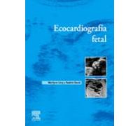 Ecocardiografía fetal