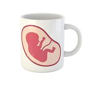 Ecografía Del Feto En El Útero, Signo Del Plano Uterino Tazón De Café Graciosa Tazón Cerámica Tazas Té Regalos Novedosos Para Amigos Familiares Novios 330Ml