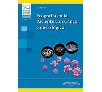 Ecografía en la Paciente con Cáncer Ginecológico