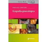 Ecografía Ginecológica