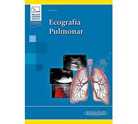 Ecografía Pulmonar