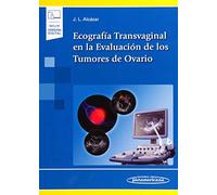 Ecografía Transvaginal En La Evaluación De Los Tumores De Ovario (libr
