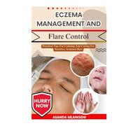 Eczema Management And Flare Control: Practical Tips For Calming And Caring For Sensitive, Irritated Skin