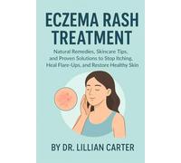 Eczema Rash Treatment: Natural Remedies, Skincare Tips, and Proven Solutions to Stop Itching, Heal Flare-Ups, and Restore Healthy Skin