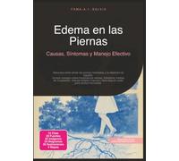 Edema en las Piernas: Causas, Síntomas y Manejo Efectivo (Enfermedades vasculares)