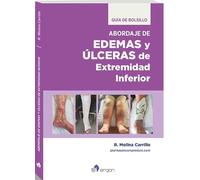 Edemas y úlceras de extremidad inferior. Guía de bolsillo