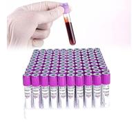 EDTA K2 - Tubos de recolección de sangre de vidrio, 5 ml, 100 tubos de extracción de sangre al vacío, con tapas de rosca moradas, para laboratorio