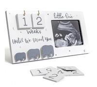 EduPlayte Marco Para Foto De Ultrasonido Regalo De Embarazo, Marco Para Sonograma Bebé Contador Semanas, Regalos Para Mamá En Espera Anuncio De Embarazo, Calendario Semanas Mamá Embarazada