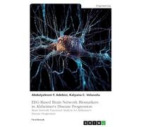 EEG-Based Brain Network Biomarkers in Alzheimer's Disease Progression: Brain Network Functional Analysis for Alzheimer's Disease Progression