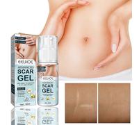 Eelhoe Scar Removal Gel