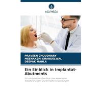 Ein Einblick in Implantat-Abutments