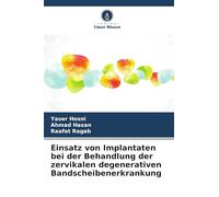 Einsatz von Implantaten bei der Behandlung der zervikalen degenerativen Bandscheibenerkrankung
