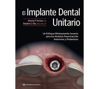 El Implante Dental Unitario