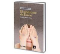 El Sindrome De Down