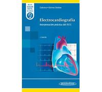 ELECTROCARDIOGRAMA:INTERPRETACION PRACTICA DEL EGG