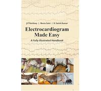 Electrocardiogram Made Easy: A Fully Illustrated Handbook