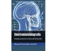 Electroencefalografía: Pasado, presente y futuro del EEG y BCI