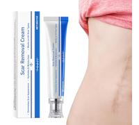 Eliminación de cicatrices - Estrías Desvanecimiento,30g Gel Reduce Estrías Queloides Heridas Queloides Lesiones Cesárea Cicatrices Nuevas y Antiguas
