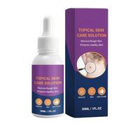 Eliminador de Verrugas,30 ml Fórmula Refrescante e Hidratante,Solución Removedora Plantar Líquida - Para Mujeres Hombres Mayores Viajes Escuela Hogar Vacaciones Interior