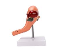 Elprico Modelo de útero Patológico, Modelo de Anatomía del Reproductor Femenino de PVC con Ovarios y Trompas de Falopio para Educación Médica y Enseñanza en el Aula