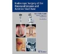 Endoscopic Surgery Of The Paranasal Sinuses And Anterior Skull Ba Se (