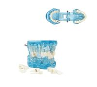 Enseñanza Dental Moho Anatomía Dental Modelo Transparente Dental Enfermedad Dental Dientes Transparentes Modelo Dental Modelo Dental Dentista Enfermedad estándar de patología removible Modelo de