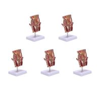 Eoslcusmvl 5X Modelo de AnatomíA, Modelo de LesióN de Hemorroides Rectales Humanos, FíStula de Hemorroides, Modelo de EnseñAnza de PatologíA