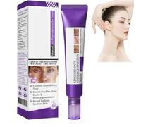 Epiglow Melanex Advanced Anti-Hyperpigmentation Cream, Dark Spot Cream, Epiglow Melanex C-ream For Hyperpigmentation Treatment, Anti-Aging Face C-ream, Dark Spot Remover For All Skin Types 20g (1)