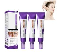 Epiglow Melanex Advanced Anti-Hyperpigmentation Cream, Dark Spot Cream, Epiglow Melanex C-ream For Hyperpigmentation Treatment, Anti-Aging Face C-ream, Dark Spot Remover For All Skin Types 20g (3)