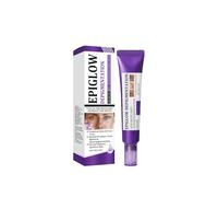 EPIGLOW MelanEX - Crema Antihiperpigmentación Avanzada Triple Acción, Antimanchas con Retinol Intensa para el Tratamiento de la Hiperpigmentación y Antiedad Facial