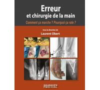 Erreur et chirurgie de la main: Comment ça marche ? Pourquoi ça rate ?