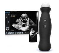 Escáner de ultrasonido veterinario inalámbrico, dispositivo de mano compatible con Android con sonda de 3,5 MHz para detección de embarazo en perros, ovejas y cerdos