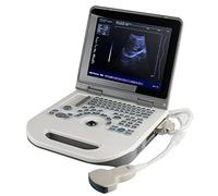 Escáner digital portátil para laptop con pantalla LED de 12.1 pulgadas, tecnología convexa multifrecuencia, batería incluida