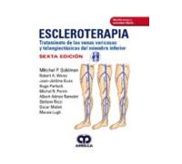 ESCLEROTERAPIA TRATAMIENTO DE LAS VENAS VARICOSAS TELANGIEC