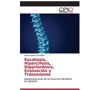 Escoliosis, Hipercifosis, Hiperlordosis, Evaluación y Tratamiento: Desalineaciones de la Columna Vertebral en General