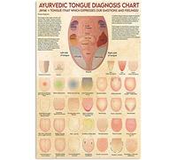 ESETASOT Cartel de metal Ayurveda para diagnóstico de lengua, decoración de pared, póster de conocimiento médico, decoración del hogar, habitación, oficina, club, clínica, hospital, 8 x 12 pulgadas