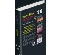 Espina Bifida + Dvd (coleccion De Medicina Fetal Y Perinatal Vol 20)