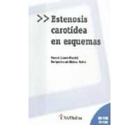 Estenosis Carotidea En Esquemas