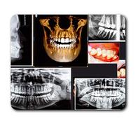 Estera cómoda del ratón - 3D Radiografía dental dentista 23.5 x 19.6 cm (9.3 x 7.7 pulgadas) para la computadora y ordenador portátil, oficina, regalo, antideslizante base - RM21052