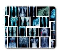 Estera cómoda del ratón - X-Ray hueso fractura de la lata pernos 23.5 x 19.6 cm (9.3 x 7.7 pulgadas) para la computadora y el ordenador portátil, oficina, regalo, base antideslizante - RM21685